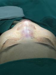 -北京米扬丽格医疗美容·联合丽格鼻整形中心