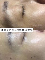 -MLP美丽派·问题肌疗愈中心