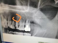 -上海市杨浦区牙病防治所