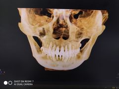 -同步齿科·数字化正畸种植口腔中心(珠海店)