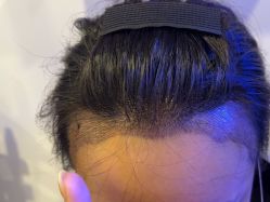 -熙朵美学植发·连锁品牌