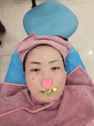 体验后-新美荟医美·专注面部美学抗衰