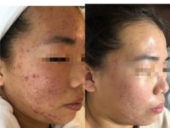 -康美贞·痘肌养护管理中心