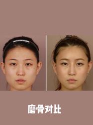 -美莱医学美容医院