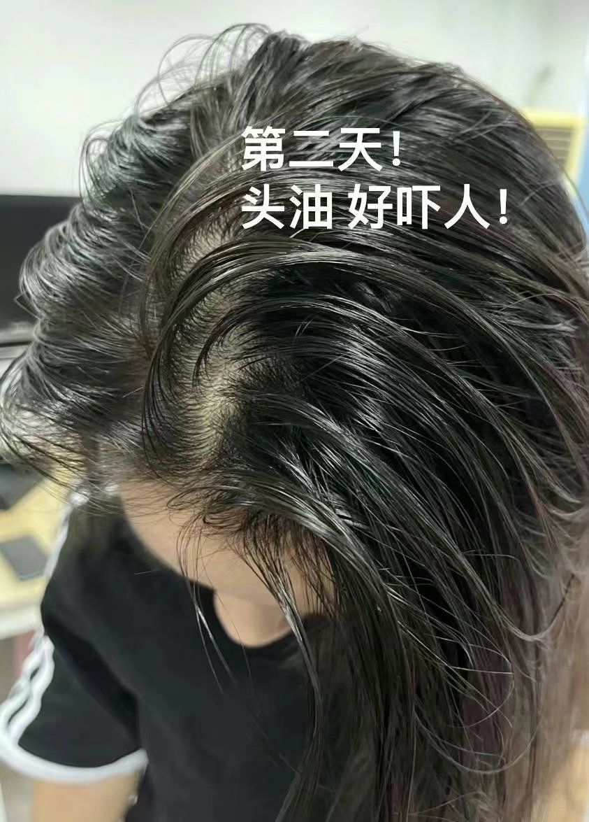 解决头发爱出油的好方法