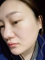 体验后-JS医疗美容