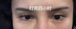 -脸博士医疗美容·眼鼻整形·抗衰中心