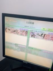 -章光101防脱养发荟