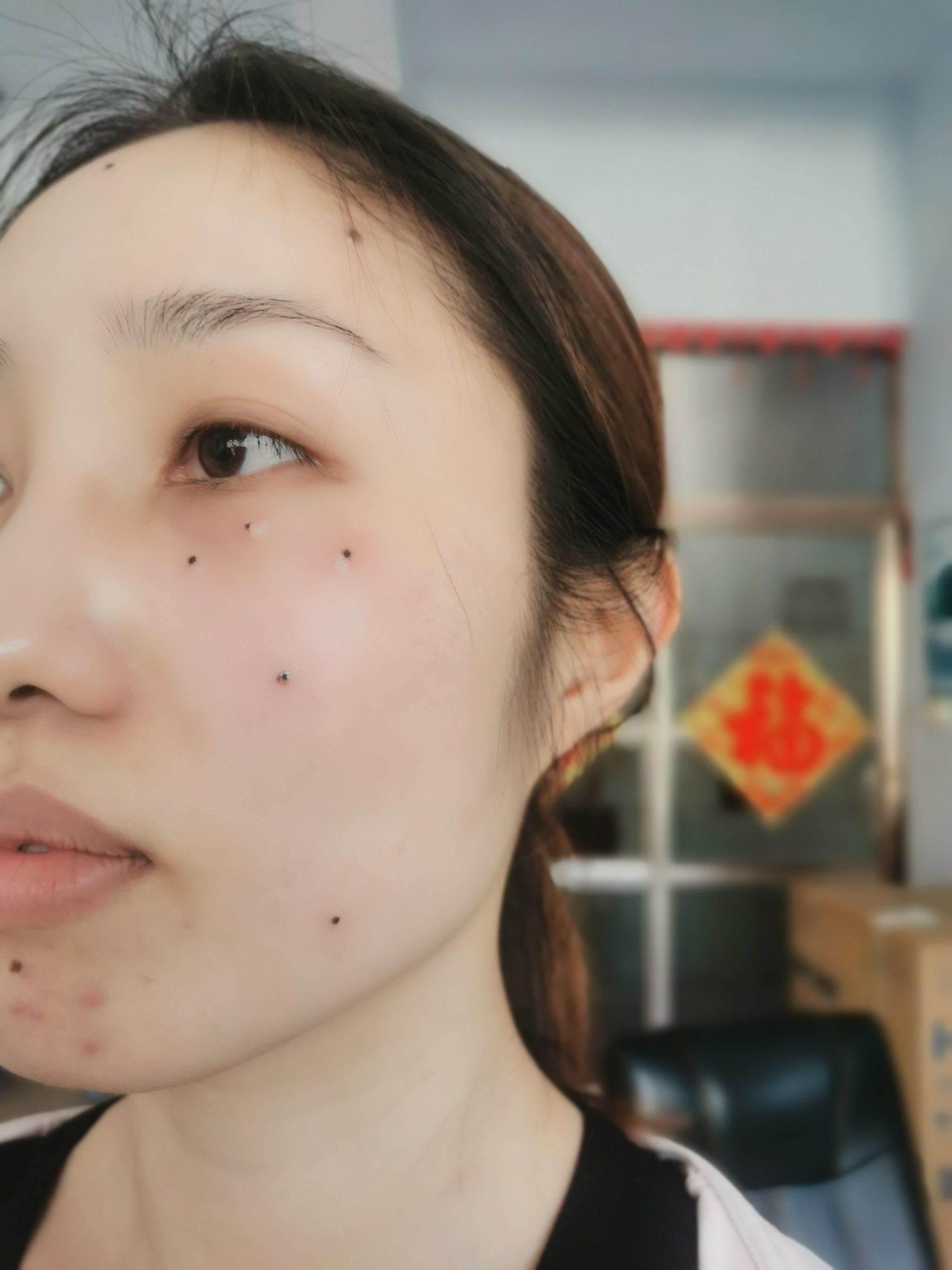 福痣缘电业局家属院对过