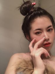 点击看大图 体验后-广东韩妃整形外科医院