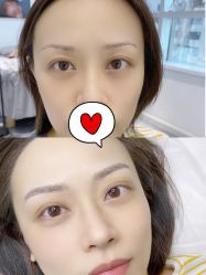 -MIVI半永久纹眉绣眉