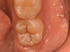 -精德口腔·种植修复·儿牙中心(财富中心店)