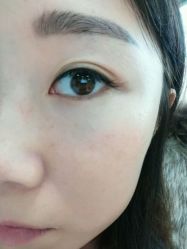 点击看大图 -YooMee优美智能科技美肤机构
