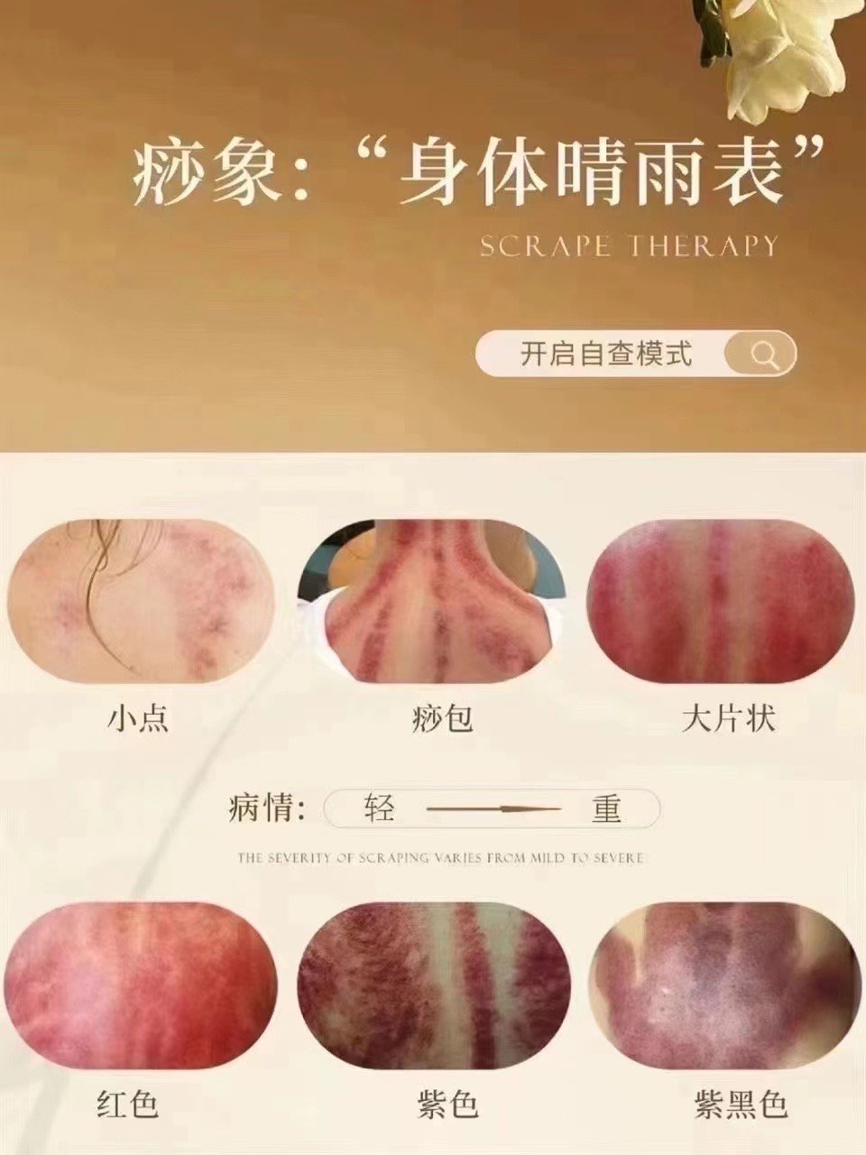 女人一年四季发痧图片