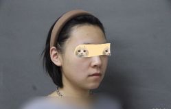 体验前-圣嘉新医疗美容医院