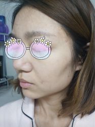 -苗方清颜•痘肌问题肌专研