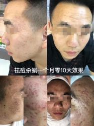 -痘敏医生专业祛痘·肌肤修复连锁