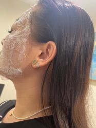 点击看大图 -海涛医疗美容·面部抗衰·注射美鼻