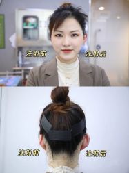 -Yestar宁波艺星整形医院