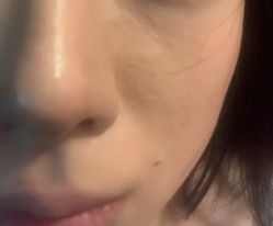 体验前-南京康美美容医院·旗舰店