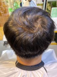 -髻尚坊增发补发织发假发定制