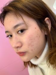 体验前-洁铭新加坡医美