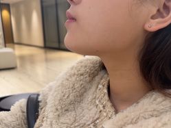 -四川米兰柏羽医学美容医院
