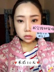 -八大处整形