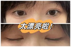 -素美医疗美容·西南眼鼻整形·修复基地