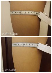 瘦身-光SPA科技美肤