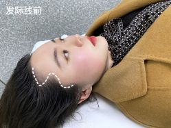 -OnFaer.纹眉半永久无创洗眉