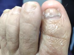 -Andrew指甲专科灰指甲·甲沟炎矫正·3D步态矫形鞋垫定制(上海法华镇路旗舰店)