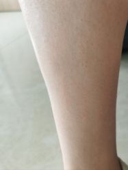 -SKIN79皮肤管理中心