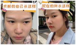 -素美医疗美容·西南眼鼻整形·修复基地