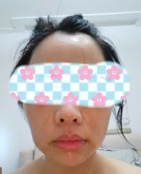体验后-上海时光整形外科医院