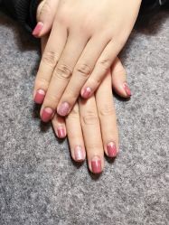 -薇兰专业脱毛连锁机构