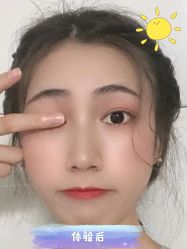 -海峡医疗美容医院