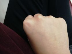 -咪咪专业脱毛连锁机构