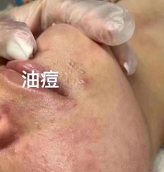 -MLP美丽派·问题肌疗愈中心
