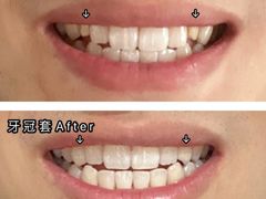 -团圆口腔·种植中心(锦江院区)