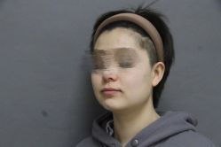 体验前-圣嘉新医疗美容医院