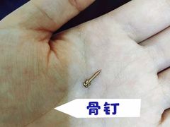 -团圆口腔·种植中心(锦江院区)