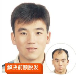 点击看大图 -发饰美男士增发补发假发定制店