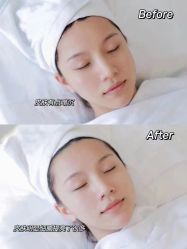 点击看大图 -美肤盾祛痘·问题肌头疗管理中心