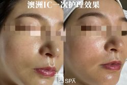 点击看大图 -栖SPA·ONDA ·海菲秀·皑皑科技美肤中心
