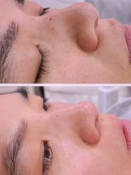 -SKIN79皮肤管理中心