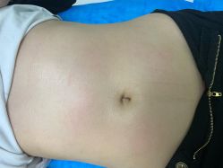 点击看大图 体验后-CMS西美斯·美式医疗美容