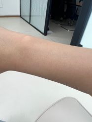 -薇兰专业脱毛连锁机构