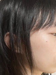 -清疣美疣·痣·斑净肤中心