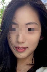-素美医疗美容·西南眼鼻整形·修复基地